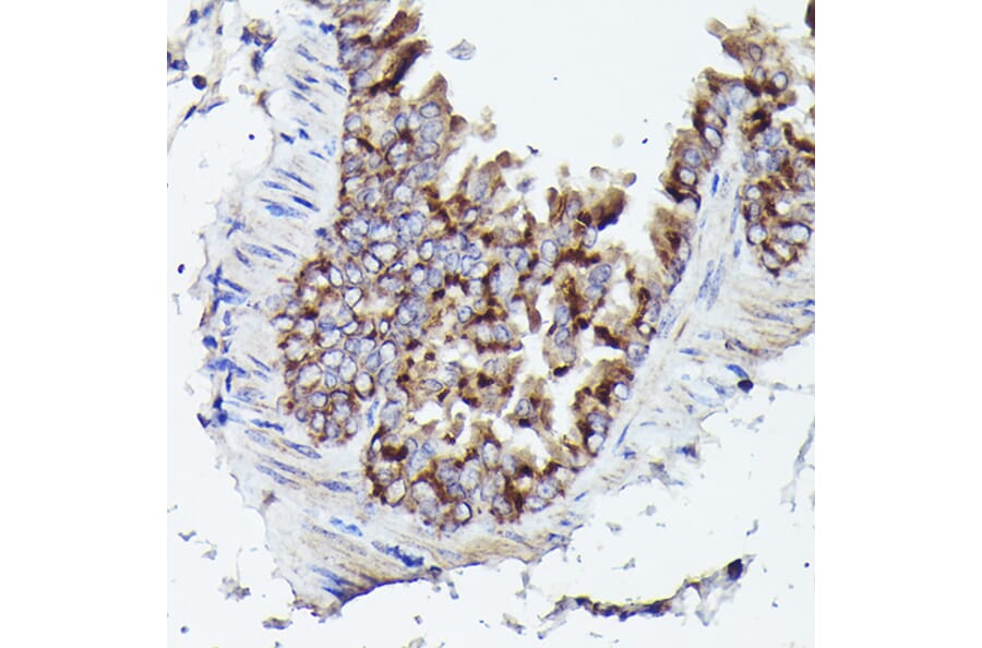 Immunohistochemistry - Anti-VDAC3 Antibody (A8647) - Antibodies.com