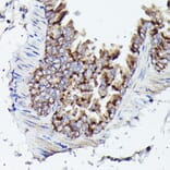 Immunohistochemistry - Anti-VDAC3 Antibody (A8647) - Antibodies.com