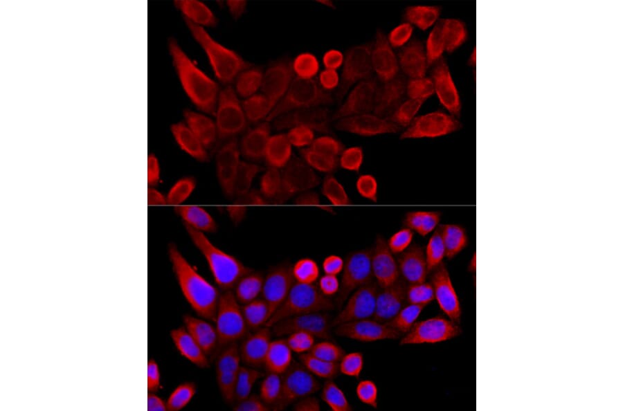 Immunofluorescence - Anti-VDAC3 Antibody (A8647) - Antibodies.com