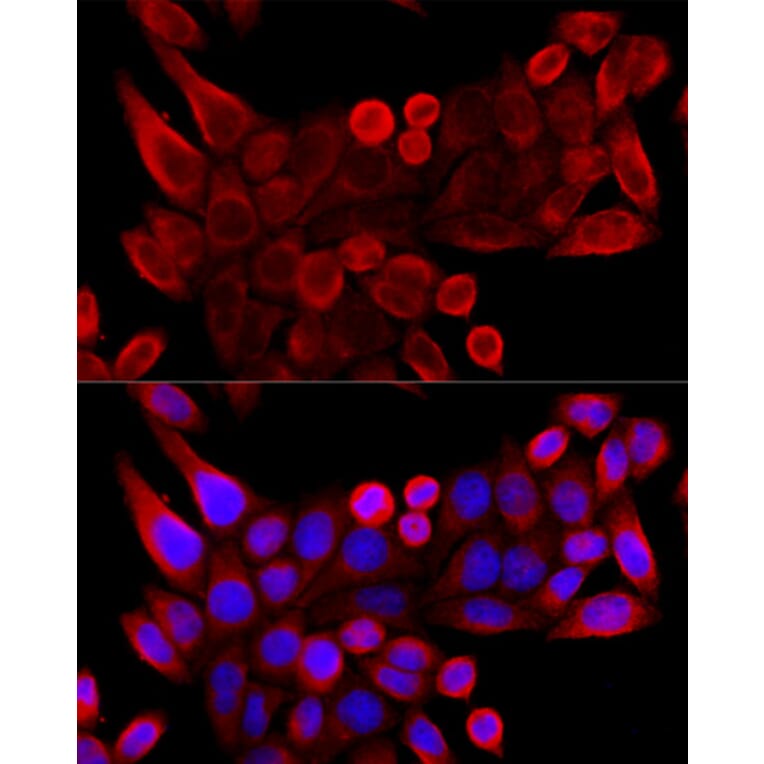 Immunofluorescence - Anti-VDAC3 Antibody (A8647) - Antibodies.com