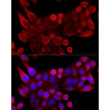 Immunofluorescence - Anti-VDAC3 Antibody (A8647) - Antibodies.com