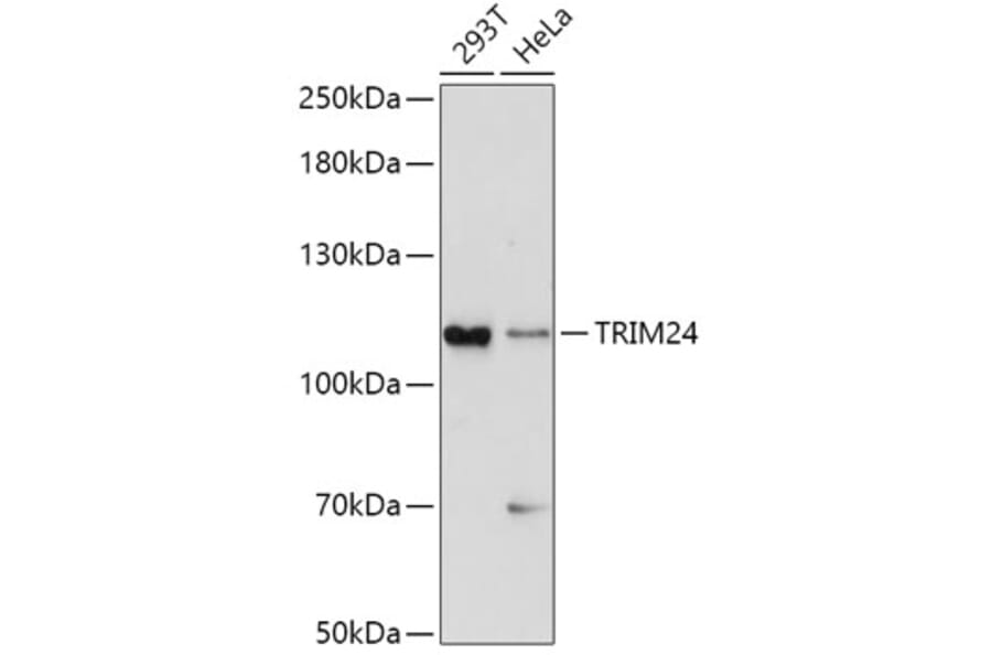 Western Blot - Anti-TRIM24 Antibody (A8648) - Antibodies.com
