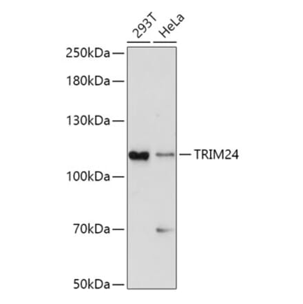 Western Blot - Anti-TRIM24 Antibody (A8648) - Antibodies.com