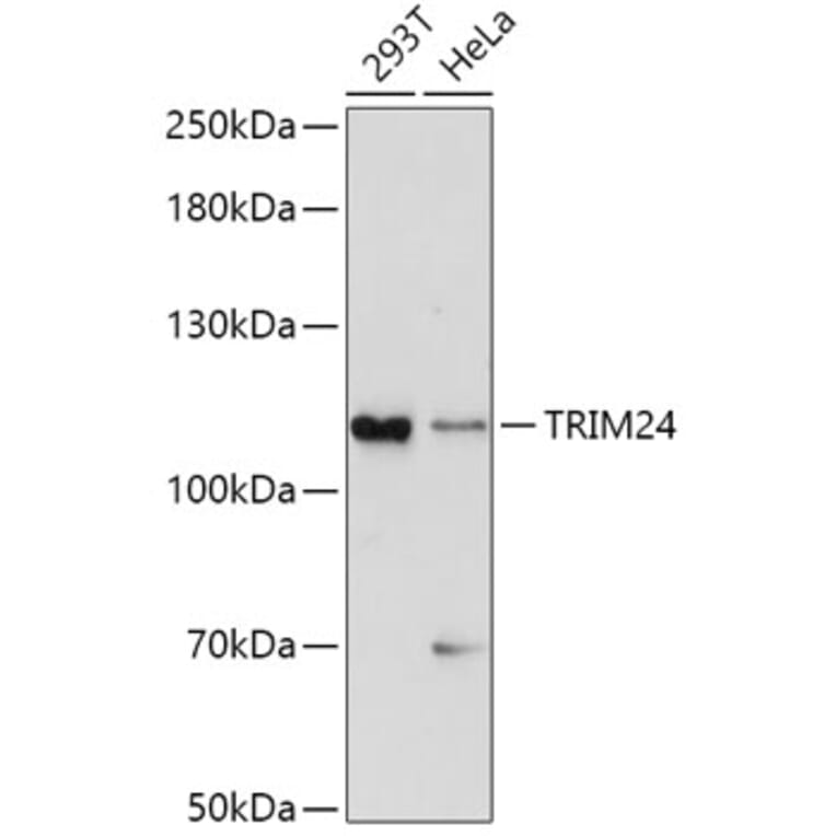 Western Blot - Anti-TRIM24 Antibody (A8648) - Antibodies.com