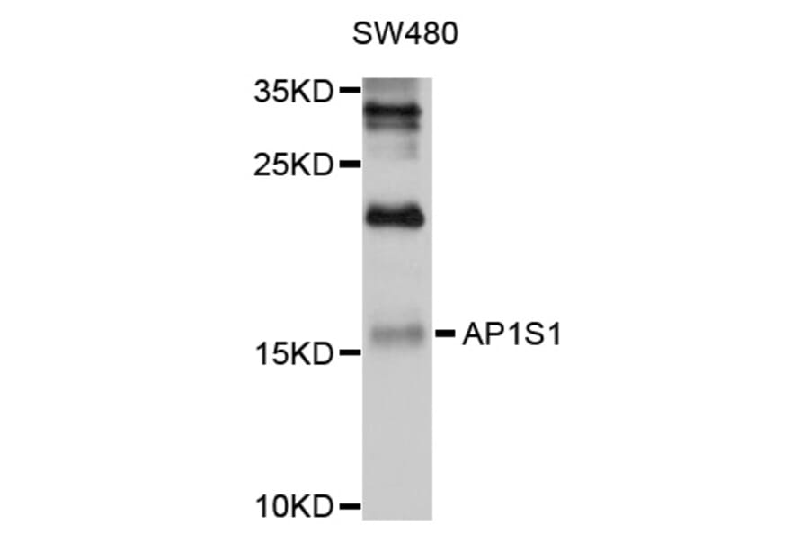 Western Blot - Anti-AP1S1 Antibody (A10558) - Antibodies.com