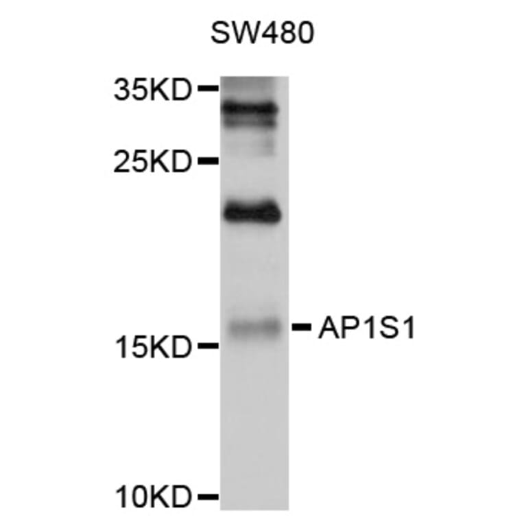 Western Blot - Anti-AP1S1 Antibody (A10558) - Antibodies.com