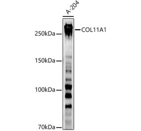 Western Blot - Anti-COL11A1 Antibody (A8650) - Antibodies.com