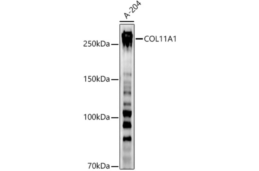 Western Blot - Anti-COL11A1 Antibody (A8650) - Antibodies.com