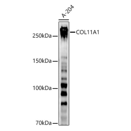 Western Blot - Anti-COL11A1 Antibody (A8650) - Antibodies.com