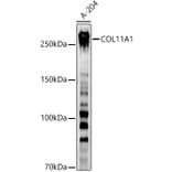 Western Blot - Anti-COL11A1 Antibody (A8650) - Antibodies.com