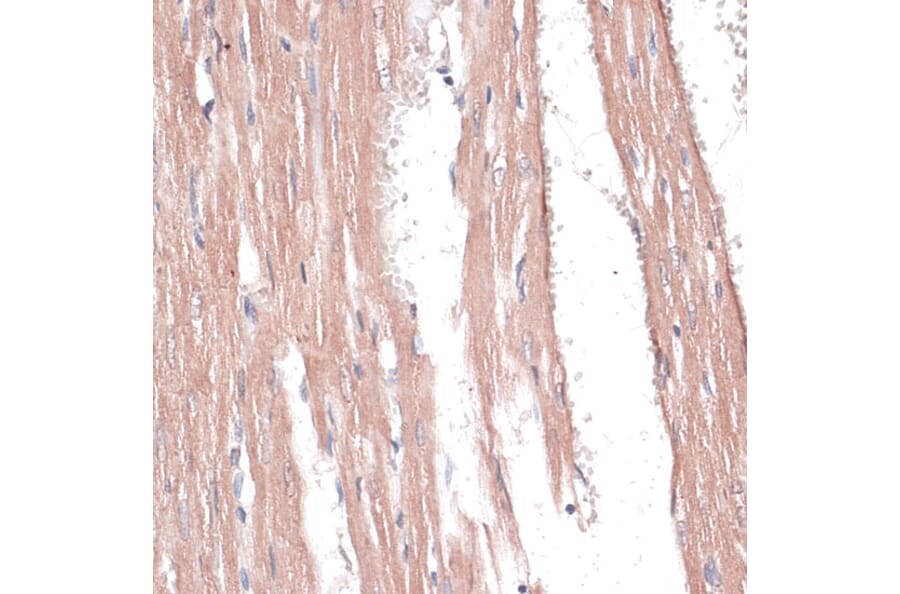 Immunohistochemistry - Anti-COL11A1 Antibody (A8650) - Antibodies.com