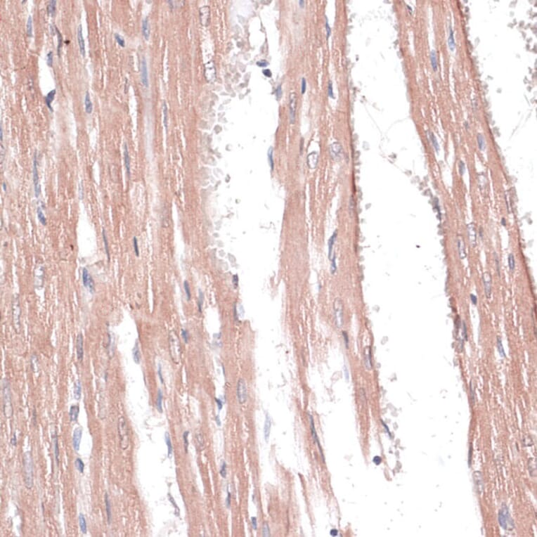 Immunohistochemistry - Anti-COL11A1 Antibody (A8650) - Antibodies.com