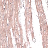 Immunohistochemistry - Anti-COL11A1 Antibody (A8650) - Antibodies.com
