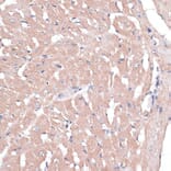 Immunohistochemistry - Anti-COL11A1 Antibody (A8650) - Antibodies.com