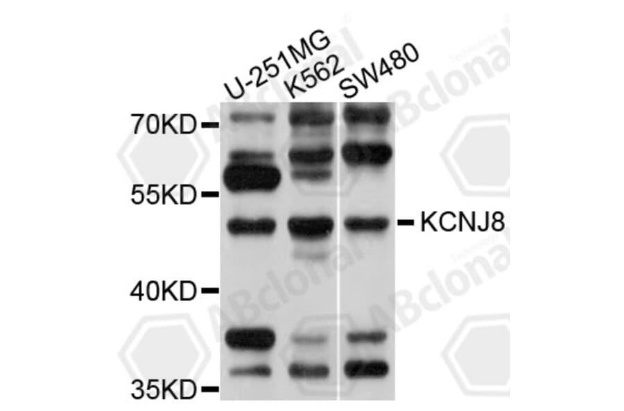 Western Blot - Anti-KCNJ8 Antibody (A10563) - Antibodies.com