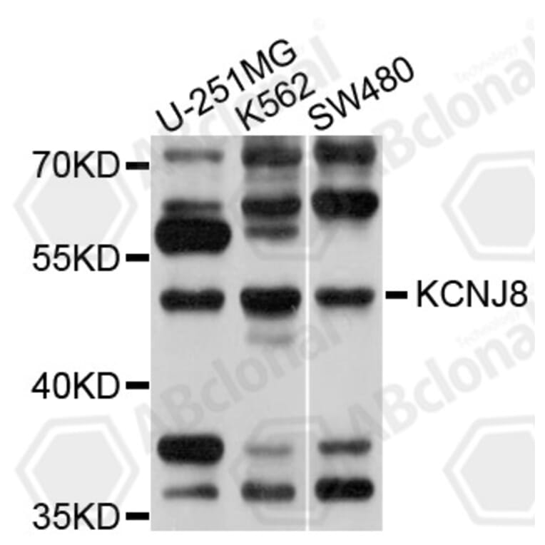Western Blot - Anti-KCNJ8 Antibody (A10563) - Antibodies.com