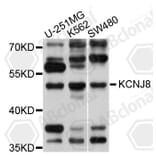 Western Blot - Anti-KCNJ8 Antibody (A10563) - Antibodies.com