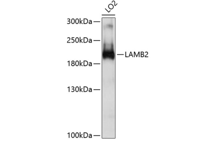Western Blot - Anti-Laminin beta 2 Antibody (A8653) - Antibodies.com