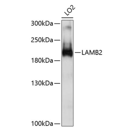 Western Blot - Anti-Laminin beta 2 Antibody (A8653) - Antibodies.com