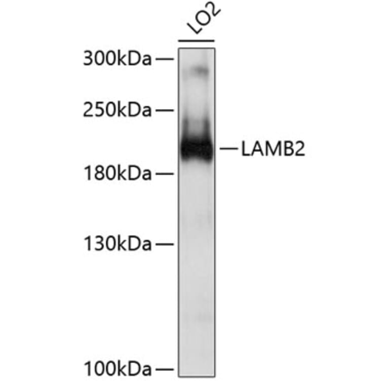 Western Blot - Anti-Laminin beta 2 Antibody (A8653) - Antibodies.com