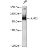 Western Blot - Anti-Laminin beta 2 Antibody (A8653) - Antibodies.com