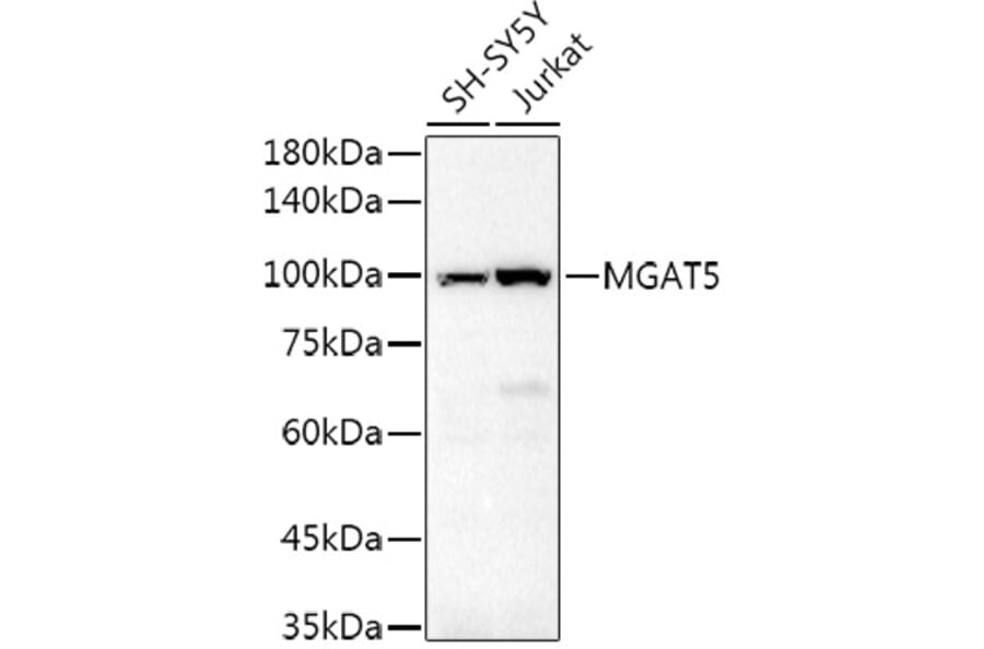 Western Blot - Anti-MGAT5 Antibody (A8655) - Antibodies.com