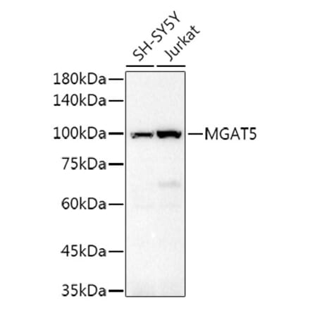 Western Blot - Anti-MGAT5 Antibody (A8655) - Antibodies.com