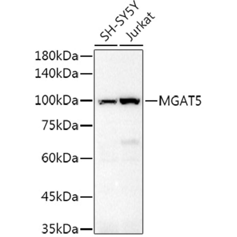 Western Blot - Anti-MGAT5 Antibody (A8655) - Antibodies.com