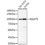 Western Blot - Anti-MGAT5 Antibody (A8655) - Antibodies.com