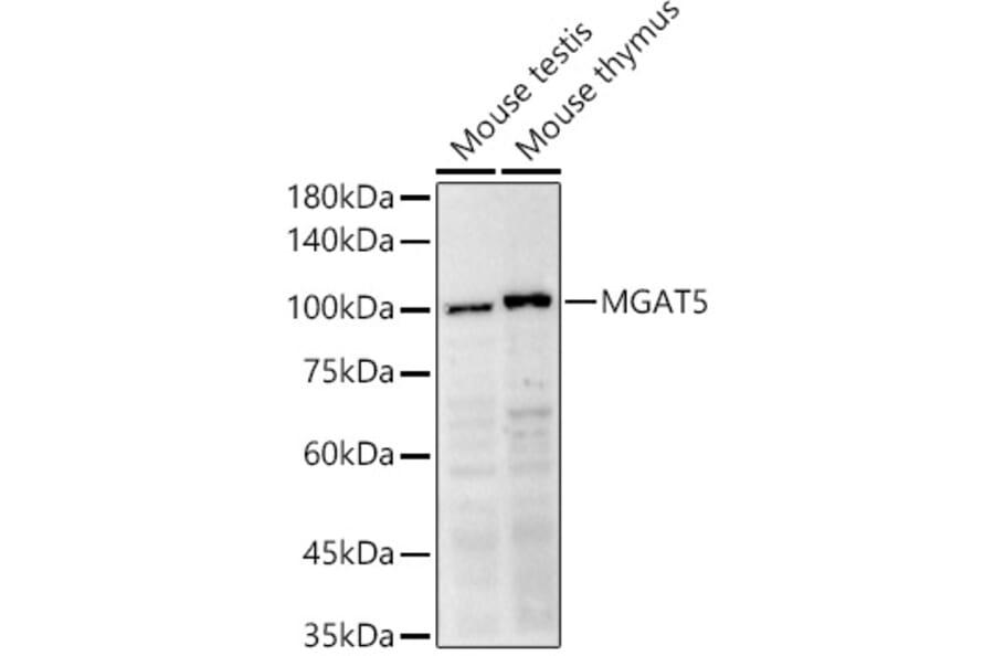 Western Blot - Anti-MGAT5 Antibody (A8655) - Antibodies.com