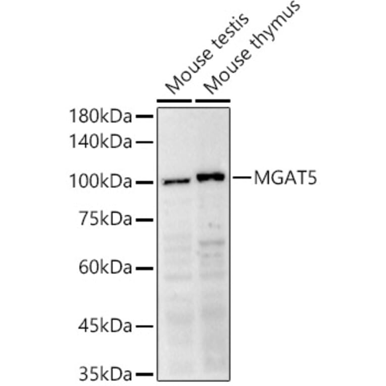 Western Blot - Anti-MGAT5 Antibody (A8655) - Antibodies.com
