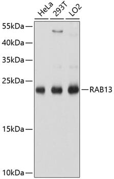Western blot analysis of extracts of various cell lines, using Anti-RAB13 Antibody (A10571) at 1:1,000 dilution.
Secondary antibody: Goat Anti-Rabbit IgG (H+L) (HRP) (AS014) at 1:10,000 dilution.
Lysates / proteins: 25µg per lane.
Blocking buffer: 3% non-fat dry milk in TBST.
Detection: ECL Basic Kit (RM00020).
Exposure time: 1s.