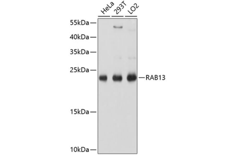 Western Blot - Anti-RAB13 Antibody (A8656) - Antibodies.com