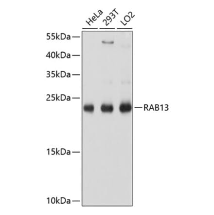 Western Blot - Anti-RAB13 Antibody (A8656) - Antibodies.com