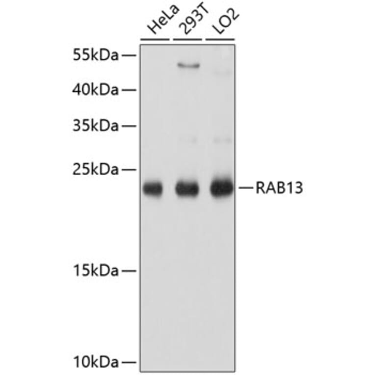 Western Blot - Anti-RAB13 Antibody (A8656) - Antibodies.com