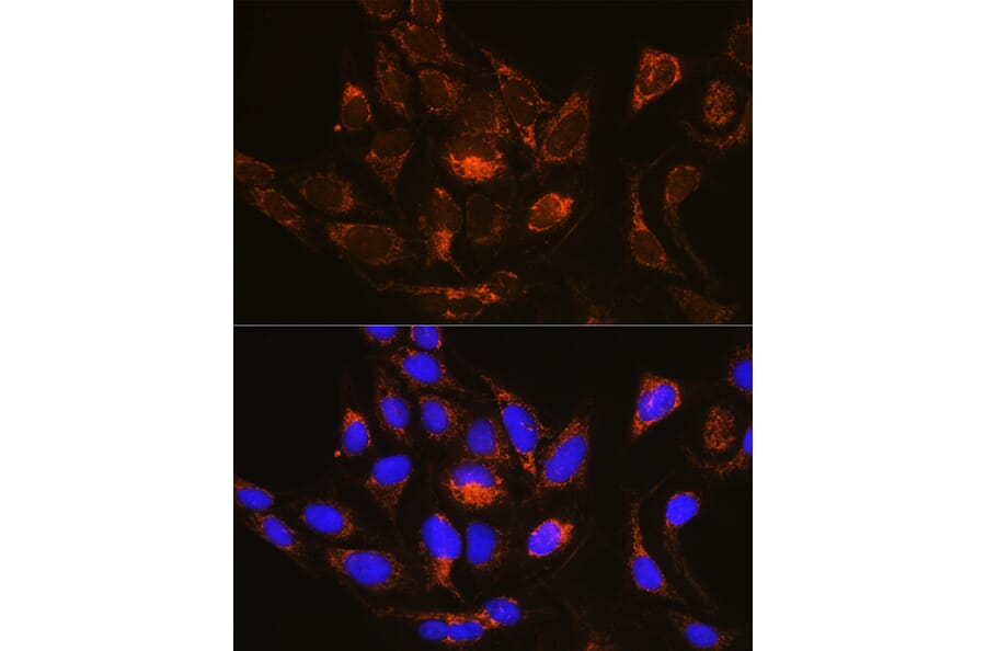 Immunofluorescence - Anti-RAB13 Antibody (A8656) - Antibodies.com