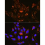 Immunofluorescence - Anti-RAB13 Antibody (A8656) - Antibodies.com
