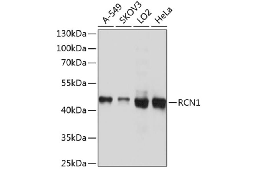 Western Blot - Anti-RCN1 Antibody (A10572) - Antibodies.com