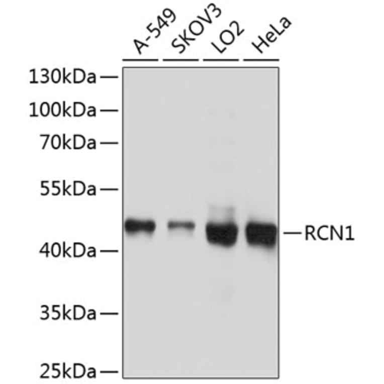 Western Blot - Anti-RCN1 Antibody (A10572) - Antibodies.com