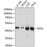 Western Blot - Anti-RCN1 Antibody (A10572) - Antibodies.com