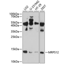 Western Blot - Anti-MRPS12 Antibody (A8658) - Antibodies.com