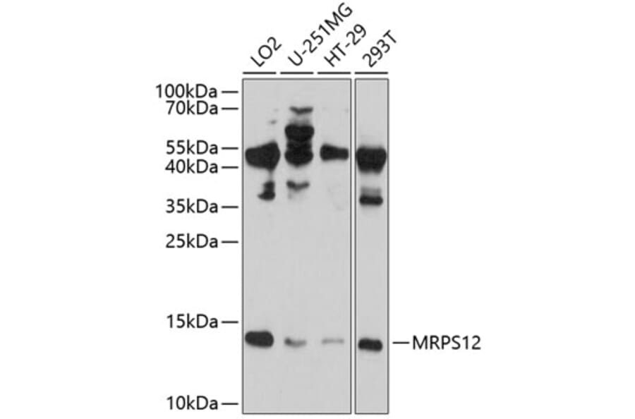 Western Blot - Anti-MRPS12 Antibody (A8658) - Antibodies.com