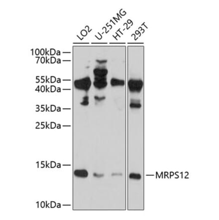 Western Blot - Anti-MRPS12 Antibody (A8658) - Antibodies.com
