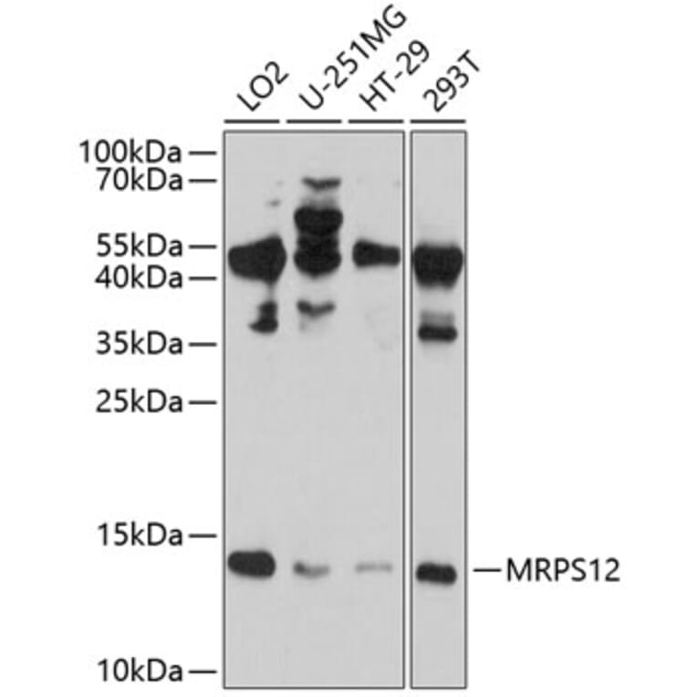 Western Blot - Anti-MRPS12 Antibody (A8658) - Antibodies.com