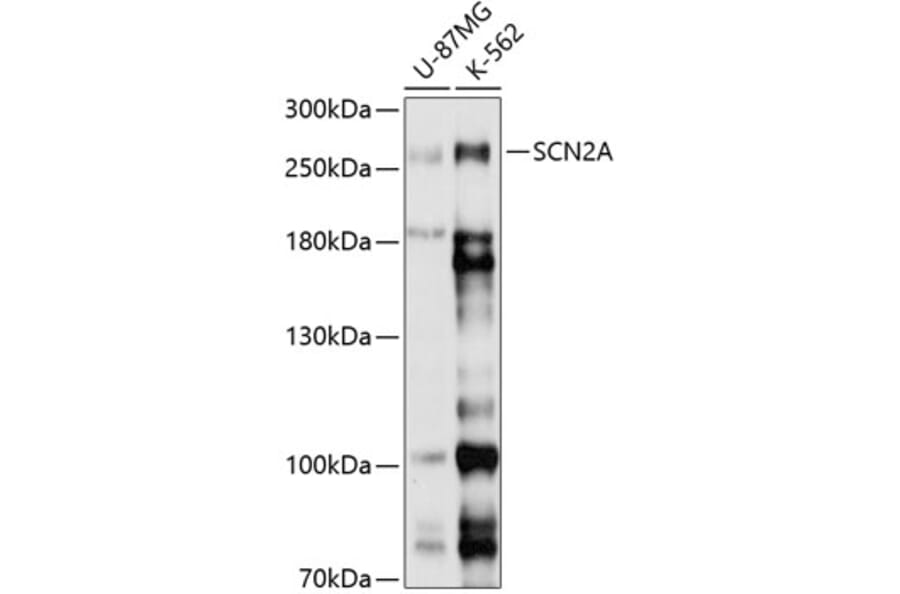 Western Blot - Anti-SCN2A Antibody (A8659) - Antibodies.com
