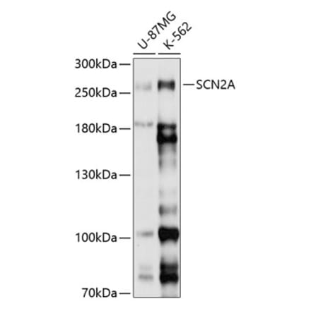Western Blot - Anti-SCN2A Antibody (A8659) - Antibodies.com