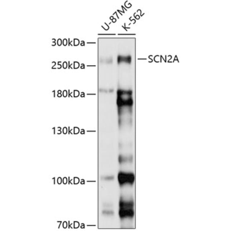 Western Blot - Anti-SCN2A Antibody (A8659) - Antibodies.com