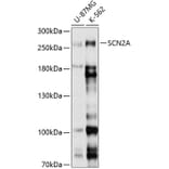 Western Blot - Anti-SCN2A Antibody (A8659) - Antibodies.com