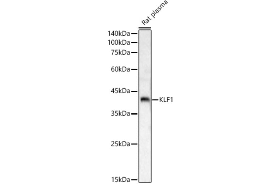 Western Blot - Anti-EKLF/KLF1 Antibody (A8661) - Antibodies.com