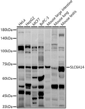 Western blot analysis of extracts of various cell lines, using Anti-SLC6A14 Antibody (A10582) at 1:1,000 dilution.
Secondary antibody: Goat Anti-Rabbit IgG (H+L) (HRP) (AS014) at 1:10,000 dilution.
Lysates / proteins: 25µg per lane.
Blocking buffer: 3% non-fat dry milk in TBST.
Detection: ECL Basic Kit (RM00020).
Exposure time: 15s.
